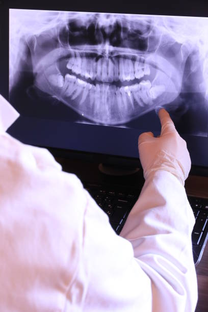 Best Urgent Care for Lost Fillings or Crowns in Pawcatuck, CT